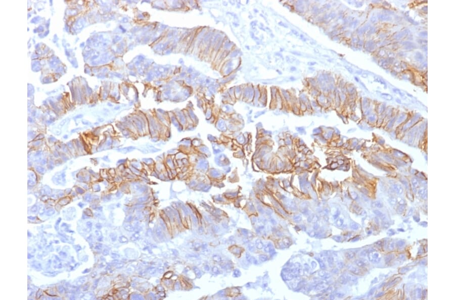 Immunohistochemistry - Anti-E Cadherin Antibody [rCDH1/1525] (A250828) - Antibodies.com