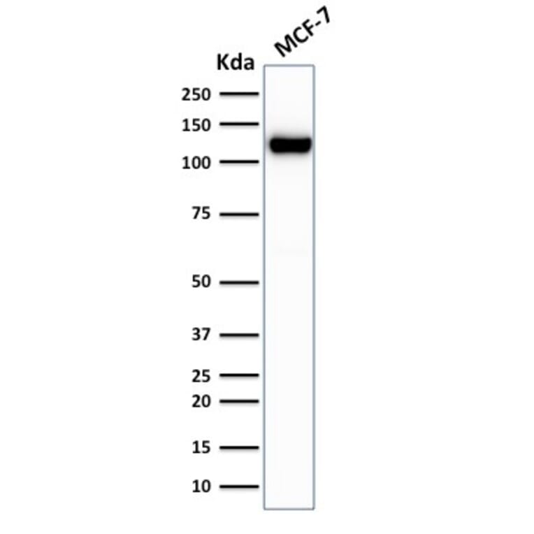 Western Blot - Anti-E Cadherin Antibody [rCDH1/1525] (A250828) - Antibodies.com