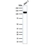 Western Blot - Anti-E Cadherin Antibody [rCDH1/1525] (A250828) - Antibodies.com