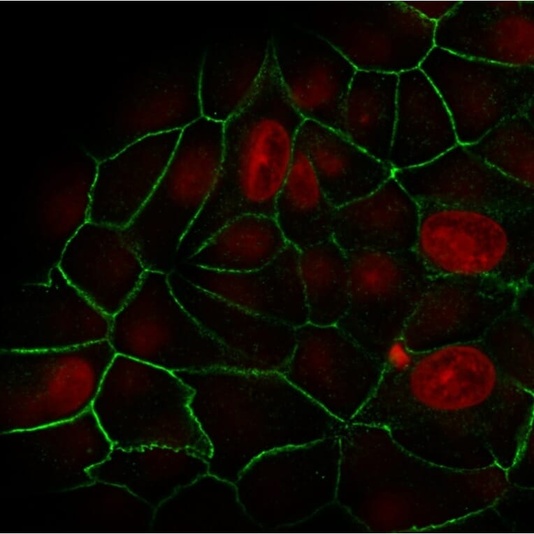 Immunofluorescence - Anti-E Cadherin Antibody [rCDH1/1525] (A250828) - Antibodies.com