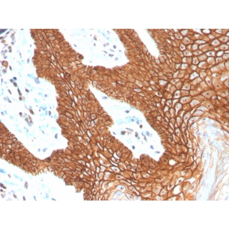Immunohistochemistry - Anti-E Cadherin Antibody [CDH1/4398R] (A250829) - Antibodies.com