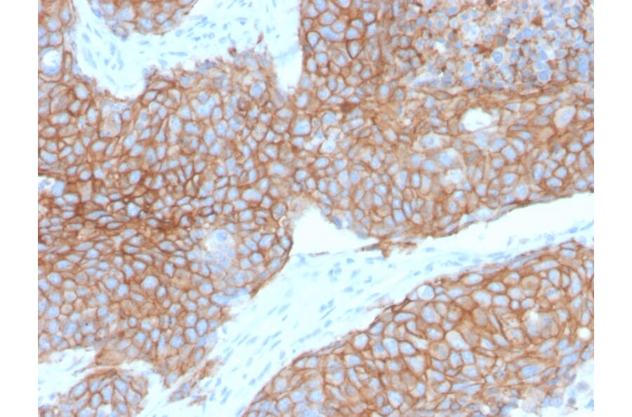 Immunohistochemistry - Anti-E Cadherin Antibody [CDH1/2208R] (A250830) - Antibodies.com