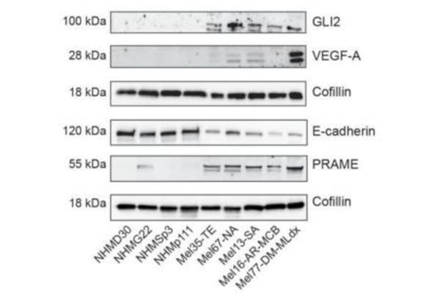 Validation Data - Anti-E Cadherin Antibody [CDH1/2208R] (A250830)