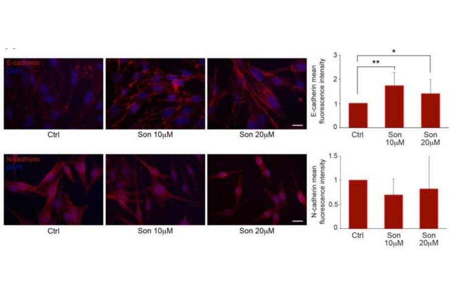 Validation Data - Anti-E Cadherin Antibody [CDH1/2208R] (A250830)