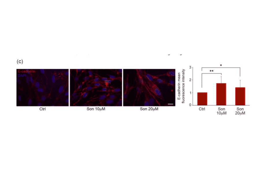 Immunofluorescence - Recombinant Anti-E Cadherin Antibody [CDH1/2208R] (A250830) - Antibodies.com