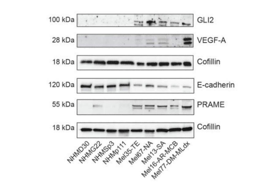 Western Blot - Recombinant Anti-E Cadherin Antibody [CDH1/2208R] (A250830) - Antibodies.com