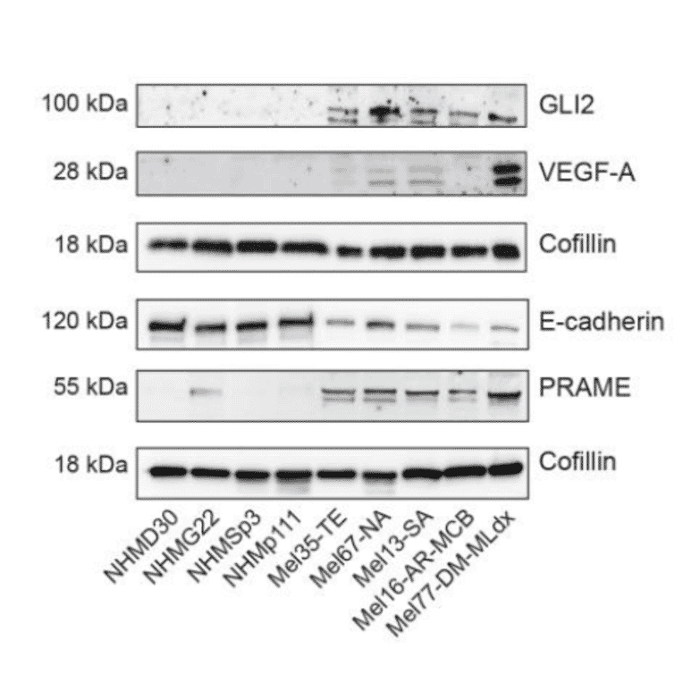 Western Blot - Recombinant Anti-E Cadherin Antibody [CDH1/2208R] (A250830) - Antibodies.com