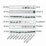 Western Blot - Recombinant Anti-E Cadherin Antibody [CDH1/2208R] (A250830) - Antibodies.com