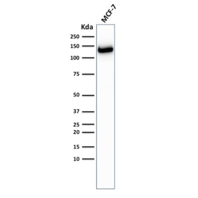 Western Blot - Anti-E Cadherin Antibody [CDH1/2208R] (A250830) - Antibodies.com