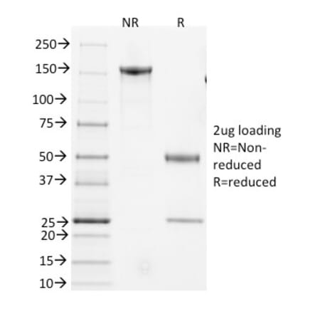 SDS-PAGE - Anti-CD3 epsilon Antibody [145-2C11] (A250830) - Antibodies.com