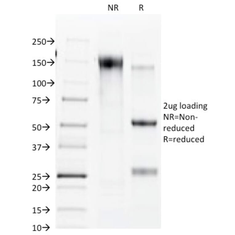SDS-PAGE - Anti-Connexin 32 Antibody [R5.21C] (A250832) - Antibodies.com