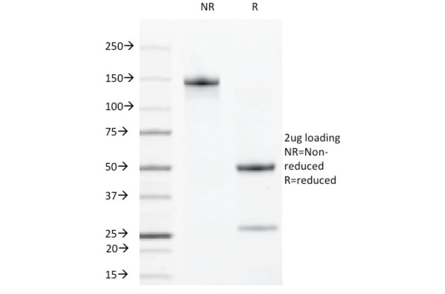 SDS-PAGE - Anti-VEGF Receptor 2 Antibody [DC101] (A250833) - Antibodies.com