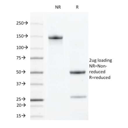 SDS-PAGE - Anti-VEGF Receptor 2 Antibody [DC101] (A250833) - Antibodies.com