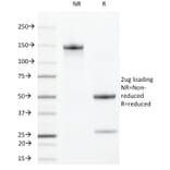 SDS-PAGE - Anti-VEGF Receptor 2 Antibody [DC101] (A250833) - Antibodies.com
