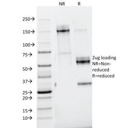 SDS-PAGE - Anti-Nidogen Antibody [ELM1] (A250834) - Antibodies.com