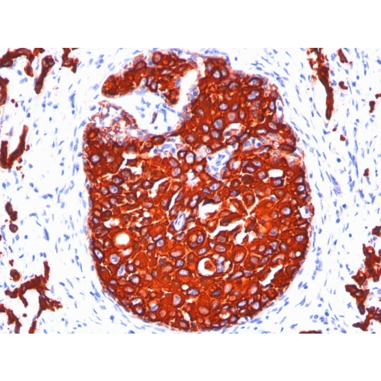 Immunohistochemistry - Anti-pan Cytokeratin Antibody [KRTL/1077 + KRTH/1076] (A250837) - Antibodies.com