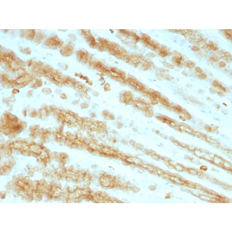 Immunohistochemistry - Anti-pan Cytokeratin Antibody [KRTL/1077 + KRTH/1076] (A250839) - Antibodies.com