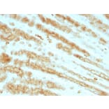 Immunohistochemistry - Anti-pan Cytokeratin Antibody [KRTL/1077 + KRTH/1076] (A250839) - Antibodies.com