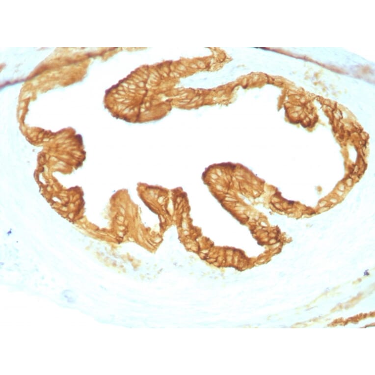 Immunohistochemistry - Anti-pan Cytokeratin Antibody [KRTL/1077 + KRTH/1076] (A250839) - Antibodies.com