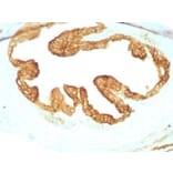 Immunohistochemistry - Anti-pan Cytokeratin Antibody [KRTL/1077 + KRTH/1076] (A250839) - Antibodies.com