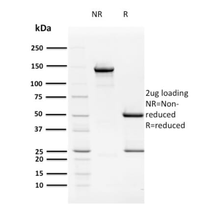 SDS-PAGE - Anti-HPV16 E2 Antibody [TVG 261] (A250839) - Antibodies.com