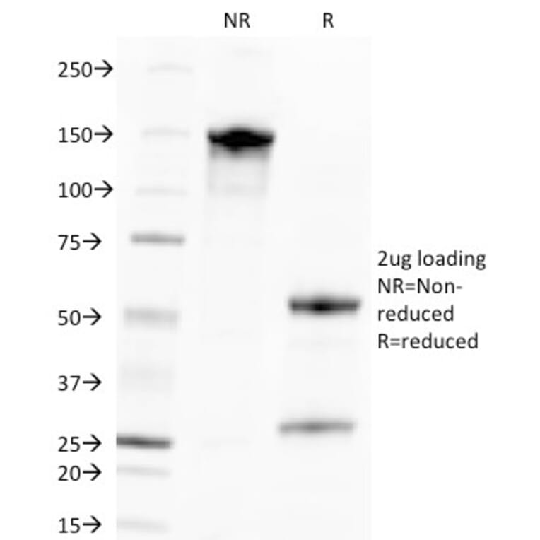 SDS-PAGE - Anti-Cytomegalovirus p65 Antibody [CMV100] (A250840) - Antibodies.com