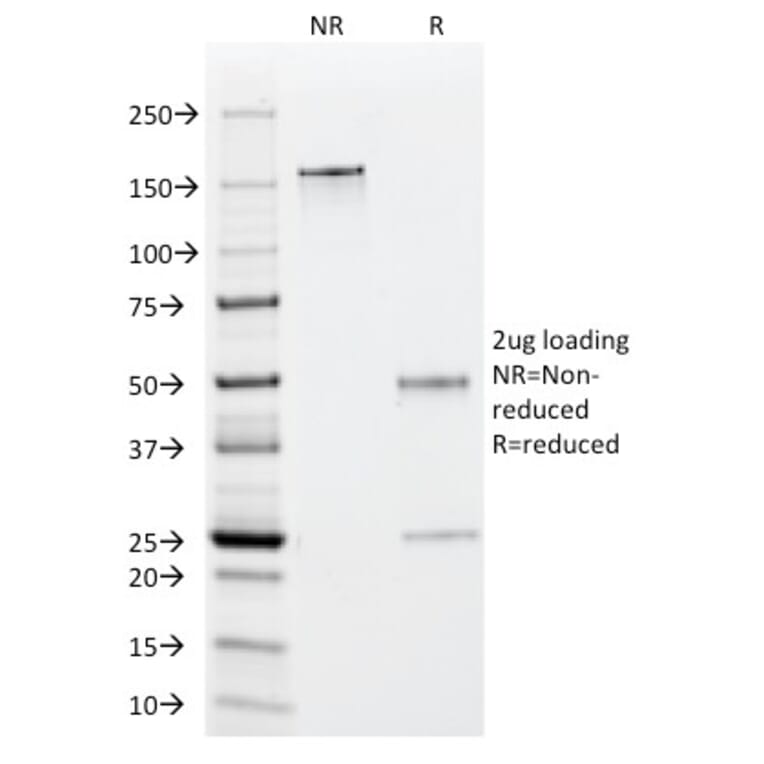 SDS-PAGE - Anti-EBV Early Antigens Antibody [1108-1] (A251563) - Antibodies.com