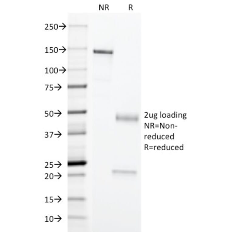 SDS-PAGE - Anti-Erythrocyte Specific Antibody [SFL23.6] (A278353) - Antibodies.com
