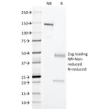 SDS-PAGE - Anti-Erythrocyte Specific Antibody [SFL23.6] (A278353) - Antibodies.com