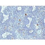 Immunohistochemistry - Anti-HPV-18 Antibody [HPV18/1297] (A250845) - Antibodies.com