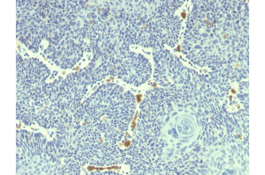 Immunohistochemistry - Anti-HPV-18 Antibody [HPV18/1297] (A250844) - Antibodies.com