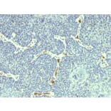 Immunohistochemistry - Anti-HPV-18 Antibody [HPV18/1297] (A250844) - Antibodies.com