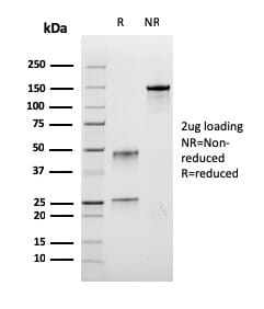 SDS-PAGE analysis of Anti-BrdU Antibody [rBRD.3] under non-reduced and reduced conditions; showing intact IgG and intact heavy and light chains, respectively. SDS-PAGE analysis confirms the integrity and purity of the antibody.