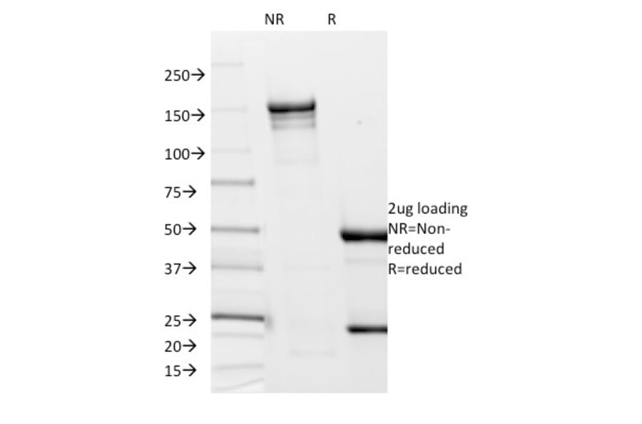 SDS-PAGE - Anti-Borrelia burgdorferi p41 Flagellin Antibody [6802] (A250846) - Antibodies.com
