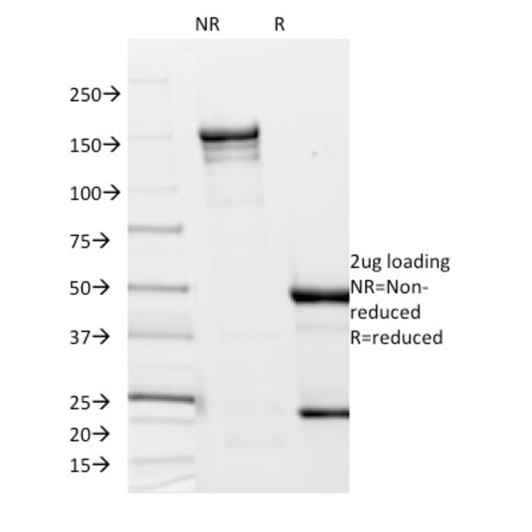 SDS-PAGE - Anti-Borrelia burgdorferi p41 Flagellin Antibody [6802] (A250846) - Antibodies.com
