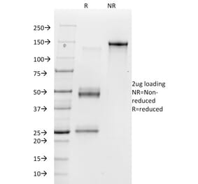 SDS-PAGE - Anti-Integrin alpha V Antibody [23C6] (A250848) - Antibodies.com