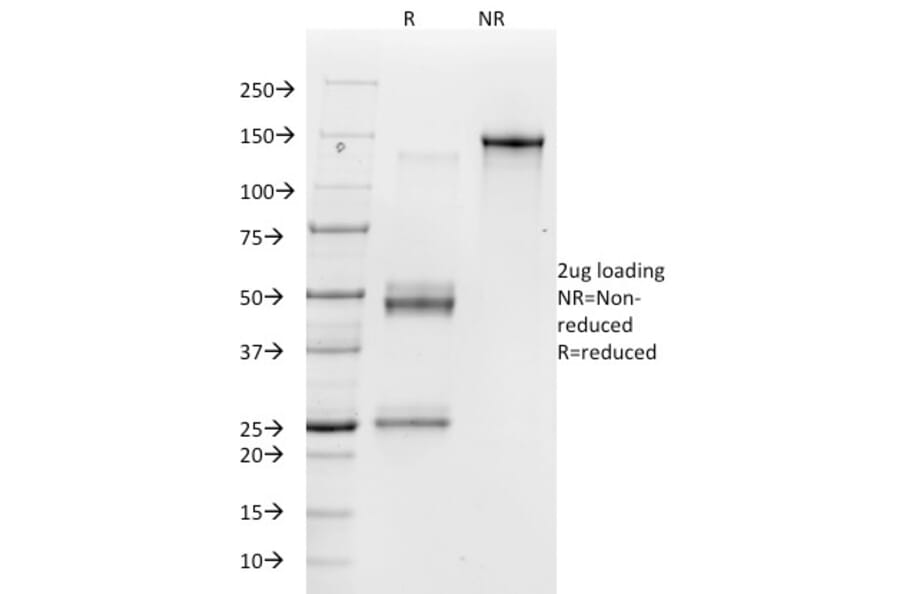 SDS-PAGE - Anti-Integrin alpha V Antibody [23C6] (A250848) - Antibodies.com