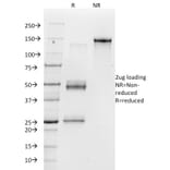SDS-PAGE - Anti-Integrin alpha V Antibody [23C6] (A250848) - Antibodies.com