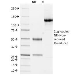 SDS-PAGE - Anti-Cytokeratin 10 + 13 Antibody [DE-K13] (A250850) - Antibodies.com