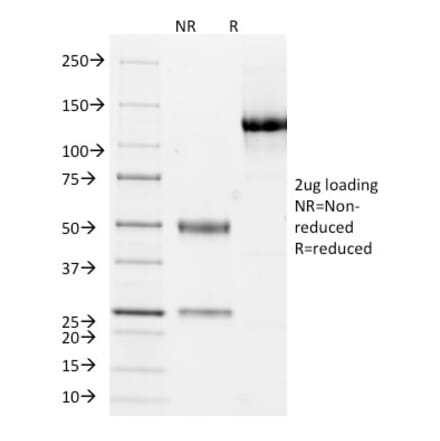 SDS-PAGE - Anti-Cytokeratin 10 + 13 Antibody [DE-K13] (A250850) - Antibodies.com