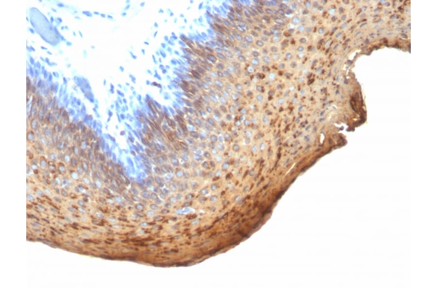 Immunohistochemistry - Anti-Cytokeratin 10 + 13 Antibody [DE-K13] (A250850) - Antibodies.com