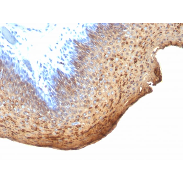 Immunohistochemistry - Anti-Cytokeratin 10 + 13 Antibody [DE-K13] (A250850) - Antibodies.com