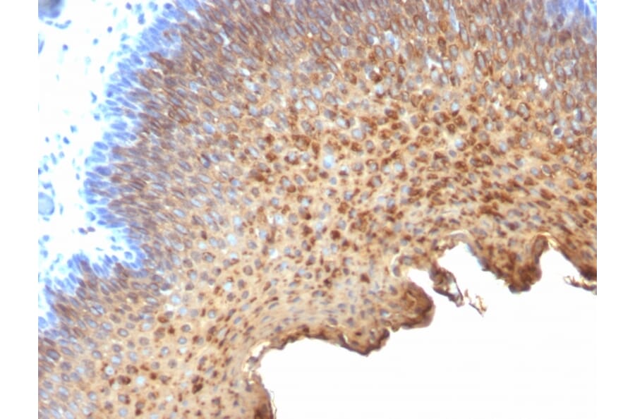 Immunohistochemistry - Anti-Cytokeratin 10 + 13 Antibody [SPM262] (A250850) - Antibodies.com