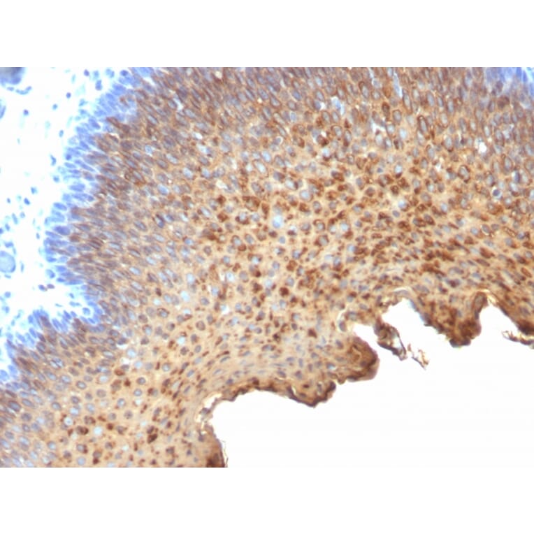 Immunohistochemistry - Anti-Cytokeratin 10 + 13 Antibody [SPM262] (A250850) - Antibodies.com