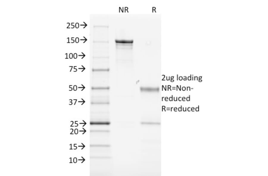 SDS-PAGE - Anti-MHC Class II Antibody [MK-D6] (A250851) - Antibodies.com