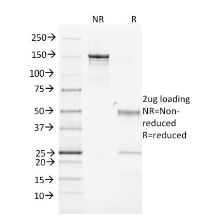 SDS-PAGE - Anti-MHC Class II Antibody [MK-D6] (A250851) - Antibodies.com