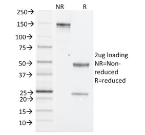 SDS-PAGE - Anti-NK1.1 Antibody [PK136] (A250852) - Antibodies.com