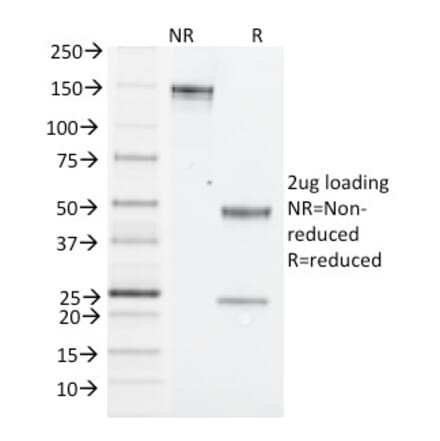 SDS-PAGE - Anti-NK1.1 Antibody [PK136] (A250852) - Antibodies.com