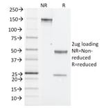 SDS-PAGE - Anti-NK1.1 Antibody [PK136] (A250852) - Antibodies.com