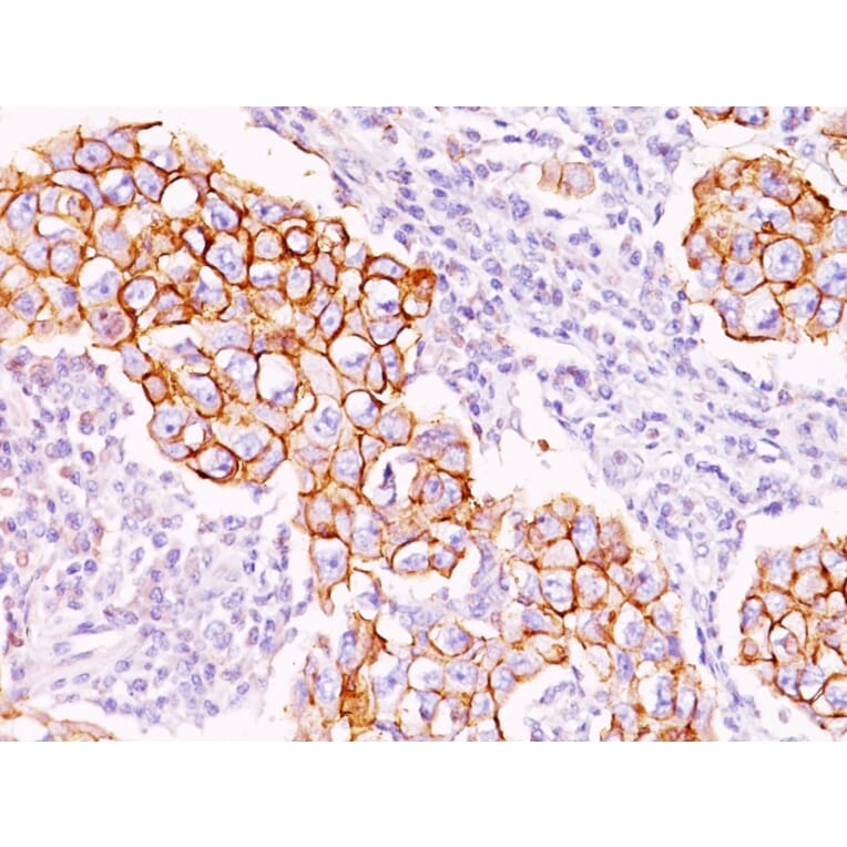 Immunohistochemistry - Anti-Phosphotyrosine Antibody [PY20] (A250856) - Antibodies.com